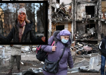 “U bë fytyra e luftës!”/ Ja historia pas fotos së gruas së gjakosur në Ukrainë