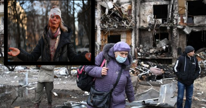 “U bë fytyra e luftës!”/ Ja historia pas fotos së gruas së gjakosur në Ukrainë