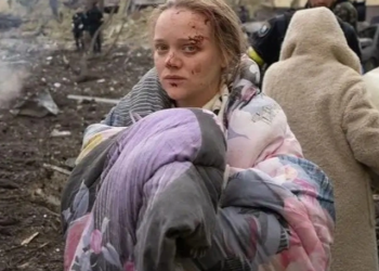 FOTOT e saj tronditën botën, rusët akuzojnë gruan shtatzënë se po “luan” rolin e viktimës