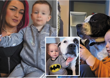 FOTO/ Qeni i familjes sulmon 2-vjeçarin, i shkakton plagë të rënda në fytyrë