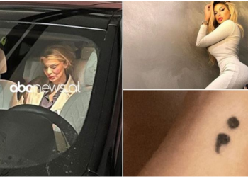 FOTO/ U fotografua me shenja dhune në fytyrë, reagon për herë të parë Luana Vjollca