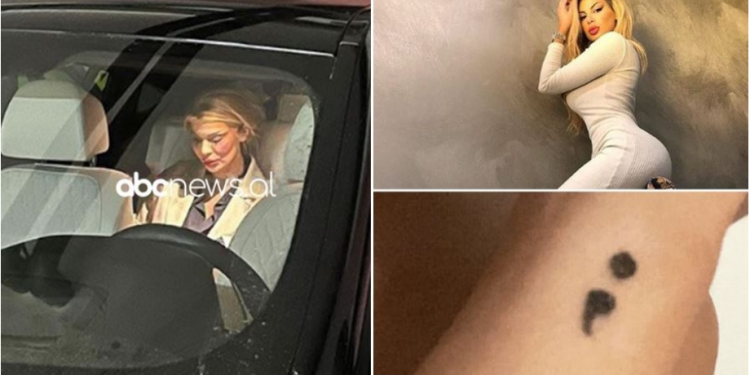 FOTO/ U fotografua me shenja dhune në fytyrë, reagon për herë të parë Luana Vjollca