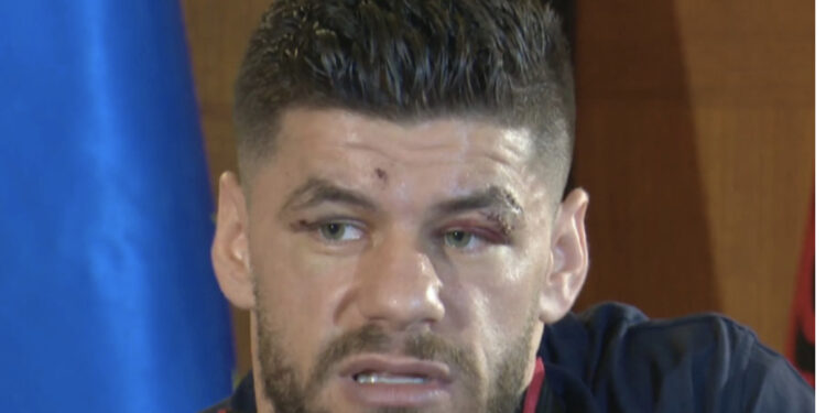 Nga jeta e vështirë te premtimi që i bëri nënës kur punonte si pastruese, Kampioni Florian Marku emocionon me fjalët