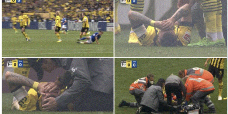 La fushën me barrellë, ylli i Dortmund dëmtohet para Botërorit të Katarit