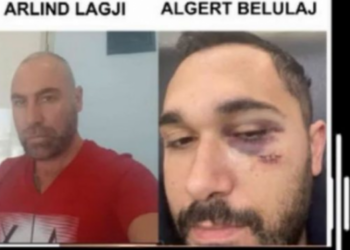 I mori gruan dhe kërcënoi me jetë qytetarin, shkarkohet drejtori i Doganës në Fier Arlind Lagji