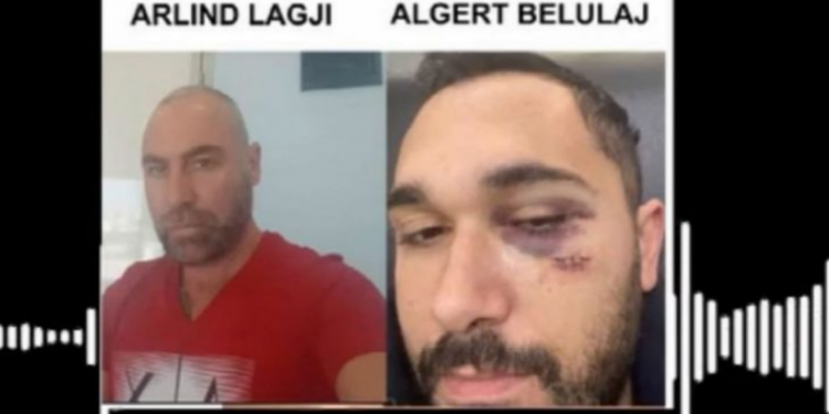 I mori gruan dhe kërcënoi me jetë qytetarin, shkarkohet drejtori i Doganës në Fier Arlind Lagji