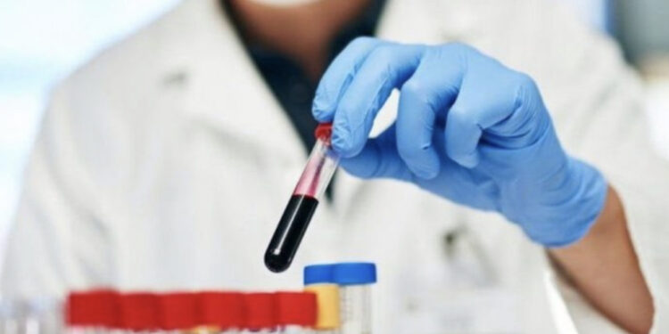 Jeni me fat nëse e keni, ky është grupi i gjakut më rezistent ndaj sëmundjeve