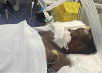 E RËNDË / 22-vjeçarja KENIANE në gjendje kome pas “dhunës barbare” në TIRANË, u gjet e hedhur pas pallatit me trauma në kokë dhe brinjë të thyera