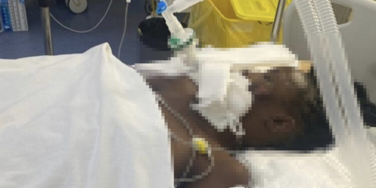 E RËNDË / 22-vjeçarja KENIANE në gjendje kome pas “dhunës barbare” në TIRANË, u gjet e hedhur pas pallatit me trauma në kokë dhe brinjë të thyera