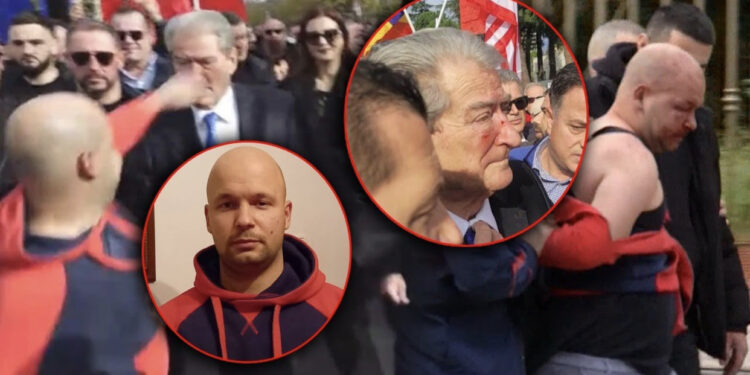 Dy lëvizjet e fundit! Nesër del para gjykatës agresori që qëlloi Berishën