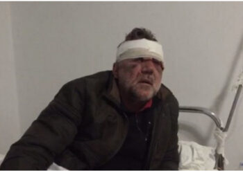 Ngacmoi seksualisht nxënëset e mitura, lihet në burg për 40 ditë mësuesi nga Tepelena