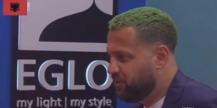 FOTO/ Është i paparë- Luizi i surprizon të gjithë përsëri me flokët, i lyen me ngjyrë të gjelbërt