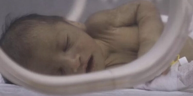 Tërmeti në Turqi-Siri: Nëna dhe foshnja shpëtohen dy herë në tri ditë nga rrënoja