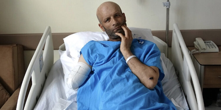 FOTO/ Historia tragjike e 41-vjeçarit turk që humbi gjymtyrët: Rrënojat ranë mbi mua, mendova se do të vdisja