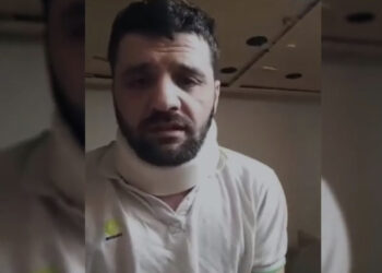 “Me zor lëviz, kam dy fëmijë”! Rrëfimi drithërues i shqiptarit: Më sakatuan policët grekë