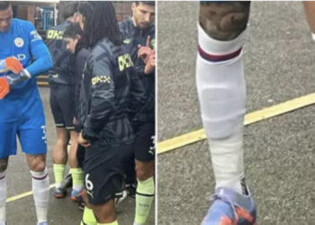 Klubi me miliona euro por pa një palë çorape, Ederson i mori hua nga Crystal Palace