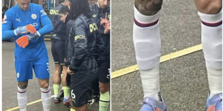 Klubi me miliona euro por pa një palë çorape, Ederson i mori hua nga Crystal Palace