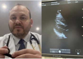 Zbulohet rasti i rrallë në Londër, 29-vjeçari shqiptar e ka zemrën në krahun e djathtë