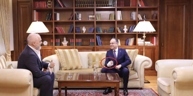 VENDIMI/ Sëmuret Presidenti! Rama i paguan shpenzimet 6 milionë lekë