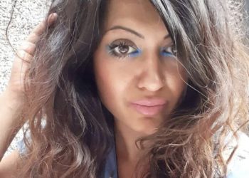 FOTO/ Ndoqi trendin e TikTok për të zier vezën, gruaja pëson djegie të rënda në fytyrë