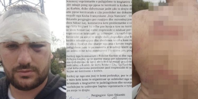 PËRGJAKET kisha e Laçit, dhunohet roja u përplas me shitësit ambulantë