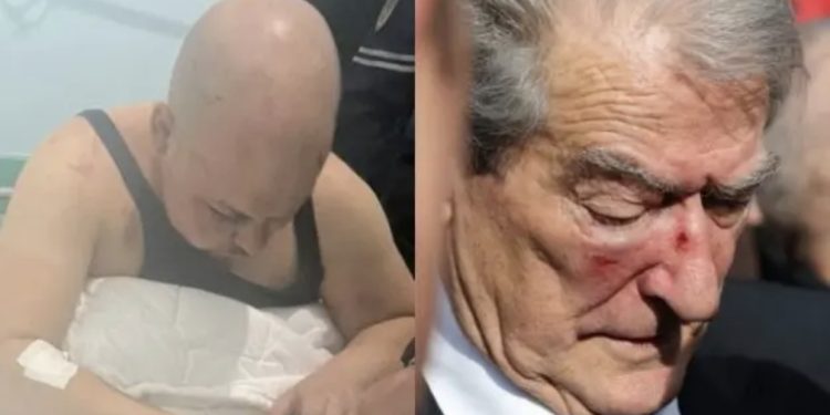 Goditi Berishën në protestën e 6 Dhjetorit, Prokuroria kërkon shtrimin në psikiatri të Gerti Shehut