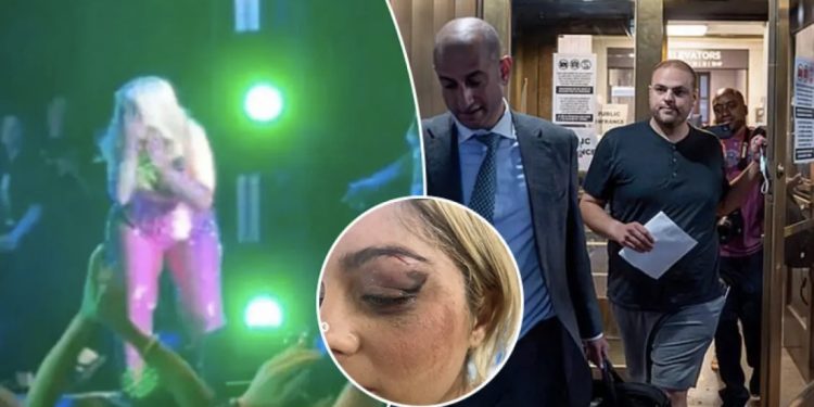 Goditi Bebe Rexhën, habit autori: Mendova se do të ishte qesharake