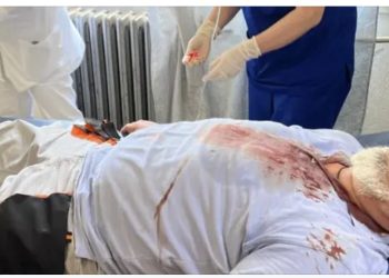 Drejtori i “Delvina gaz” goditet me levë në kokë nga 5 persona, në spital në rrezik për jetën. Policia fsheh ngjarjen