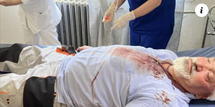 Drejtori i “Delvina gaz” goditet me levë në kokë nga 5 persona, në spital në rrezik për jetën. Policia fsheh ngjarjen