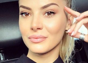 FOTO/ Çfarë ndodhi? Marina Vjollca thyen krahun