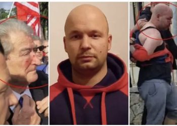 Goditi me grusht Berishën! Gjykata kyç agresorin në psikiatri