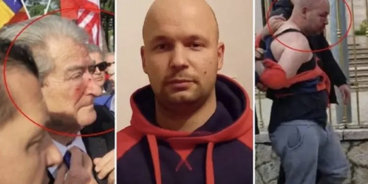 Goditi me grusht Berishën! Gjykata kyç agresorin në psikiatri