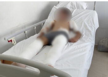 Po ruante delet i vetëm, detaje nga ngjarja e rëndë në Delvinë, 12-vjeçari i fashuar nga koka te këmbët, u sulmua nga 6 qentë e kopesë tjetër