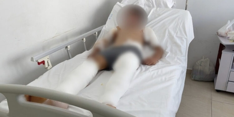 Po ruante delet i vetëm, detaje nga ngjarja e rëndë në Delvinë, 12-vjeçari i fashuar nga koka te këmbët, u sulmua nga 6 qentë e kopesë tjetër