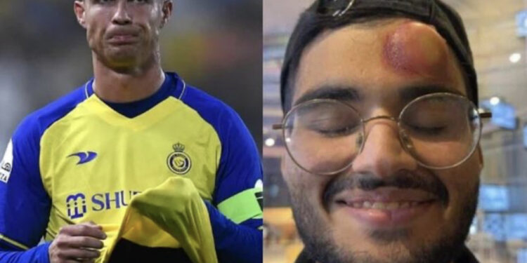 VIDEO/ Ronaldo bën për spital kameramanin, gjuajtja e tij potente i shkakton hematomë në kokë