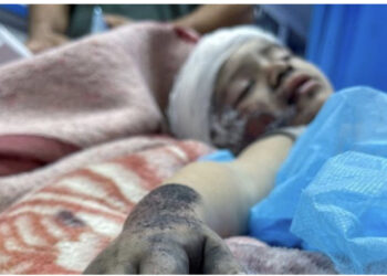 E dhimbshme/ Prindërit në Palestinë shkruajnë emrat e fëmijëve në trup për t’i identifikuar nëse vriten