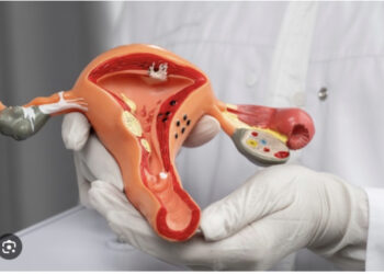 HISTORIKE/ Shkencëtarët zbulojnë trajtimin që ul ndjeshëm vdekjet nga kanceri i qafës së mitrës