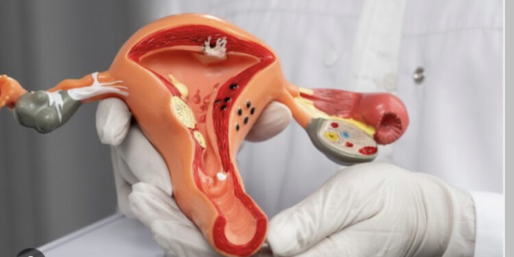 HISTORIKE/ Shkencëtarët zbulojnë trajtimin që ul ndjeshëm vdekjet nga kanceri i qafës së mitrës