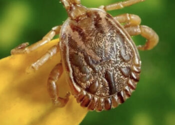 Sëmundja “meksikane” alarmon SHBA, çfarë është RMSF