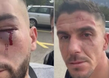 FOTO/ Kjo është gjendja e 3 shqiptarëve të dhunuar në Malin e Zi, ja detajet si ndodhi ngjarja