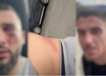“Na goditën në kokë dhe në trup”, si u dhunuan tre shqiptarët në Malin e Zi, çfarë dihet deri tani për ngjarjen