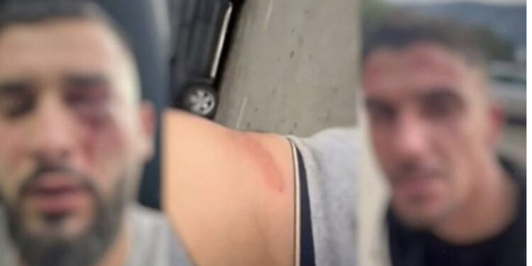 “Na goditën në kokë dhe në trup”, si u dhunuan tre shqiptarët në Malin e Zi, çfarë dihet deri tani për ngjarjen