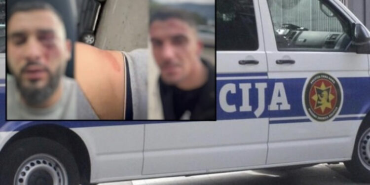 Flet një nga shqiptarët e dhunuar: Nuk provokuam, sulmuan pa shkak