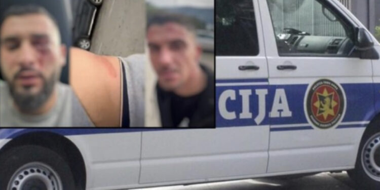 Në gjendje të rënduar psikologjike, mbërrin në familje një nga të dhunuarit në Malin e Zi: Na goditën pa asnjë arsye