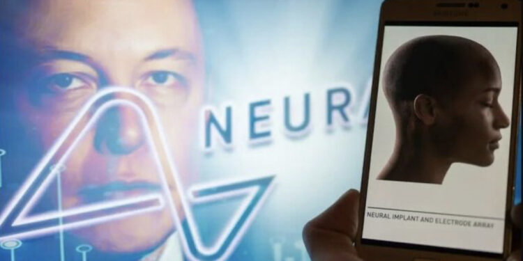 E pabesueshme/ Elon Musk njofton vendosjen e çipit të parë Neuralink te një njeri