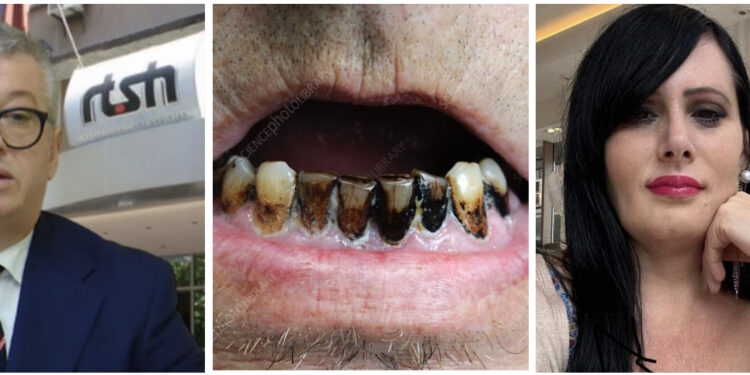 Peza, dhëmbët e zeza dhe Ivana e tmerrshme