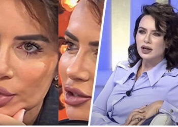 Çfarë ndërhyrje ka bërë në fytyrë Grida Duma? Mjekja i nxjerr sekretet e ‘superformës’