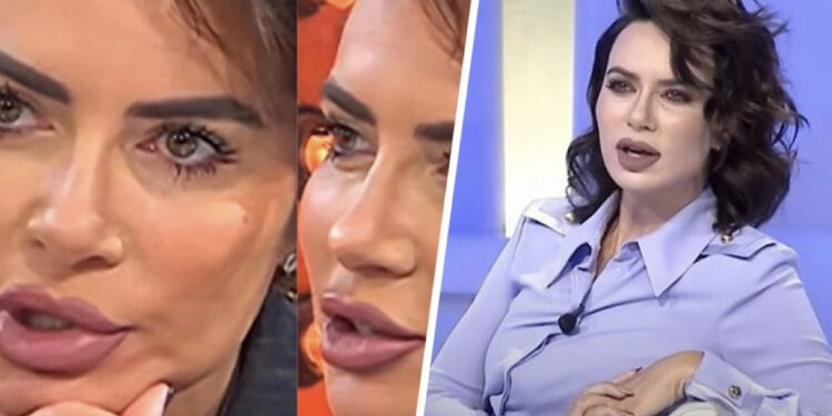 Çfarë ndërhyrje ka bërë në fytyrë Grida Duma? Mjekja i nxjerr sekretet e ‘superformës’