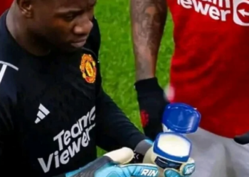 Tifozët vunë re një detaj të çuditshëm: Pse portieri i United i lyen dorezat me vazelinë