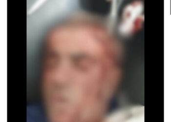 FOTO/ Polici u dhunua para banesës, Berisha ndan pamjet: I kanë çarë kokën, krimi mbahet i fshehtë